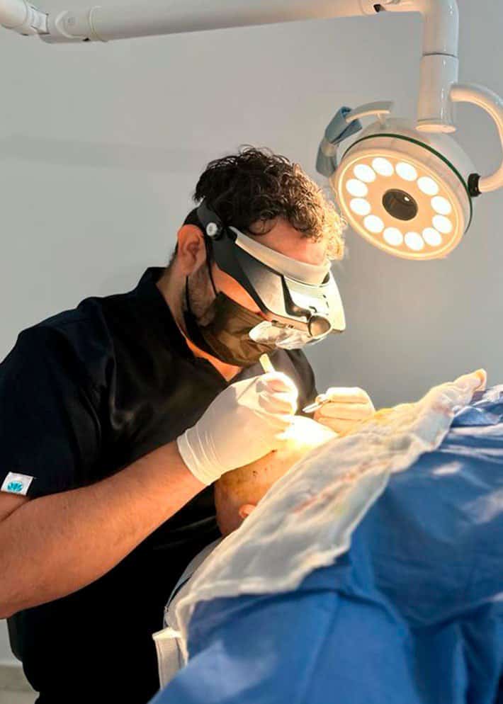 Injerto capilar, barba o ceja